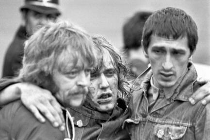 Photo of a bloodied and beaten miner being carried away by his colleagues